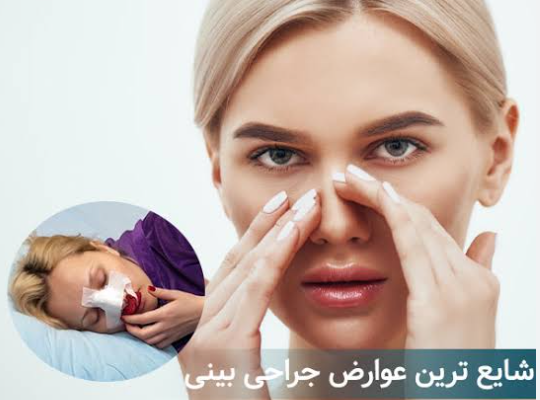 جراحی بینی